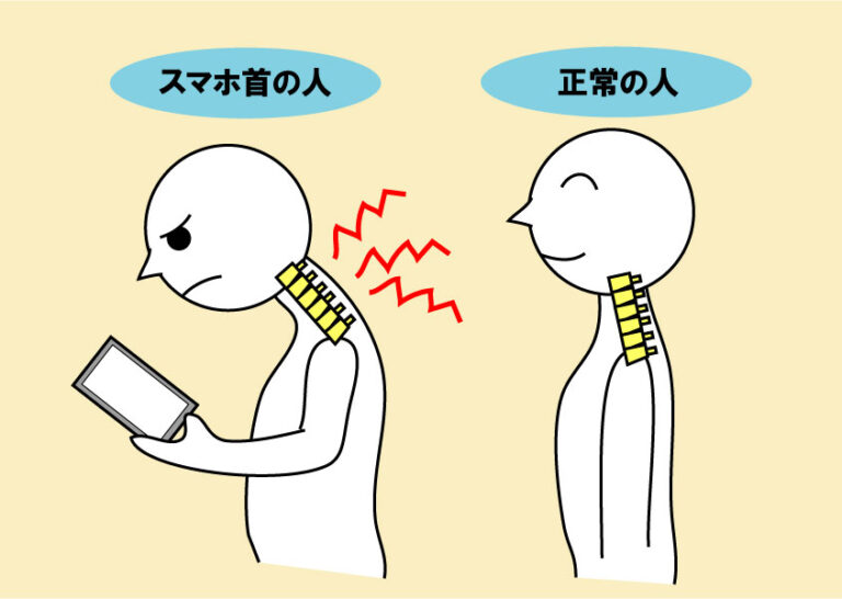 所沢でスマホ首にお悩みの方へ｜首こり・頭痛の原因を根本改善【所沢なないろ整骨院】